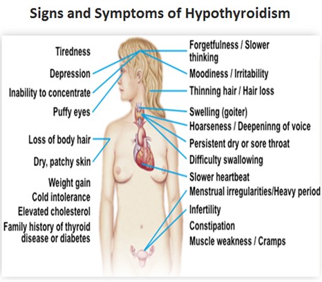 1-Image-Symptoms-Clinical features-Hypothyroid